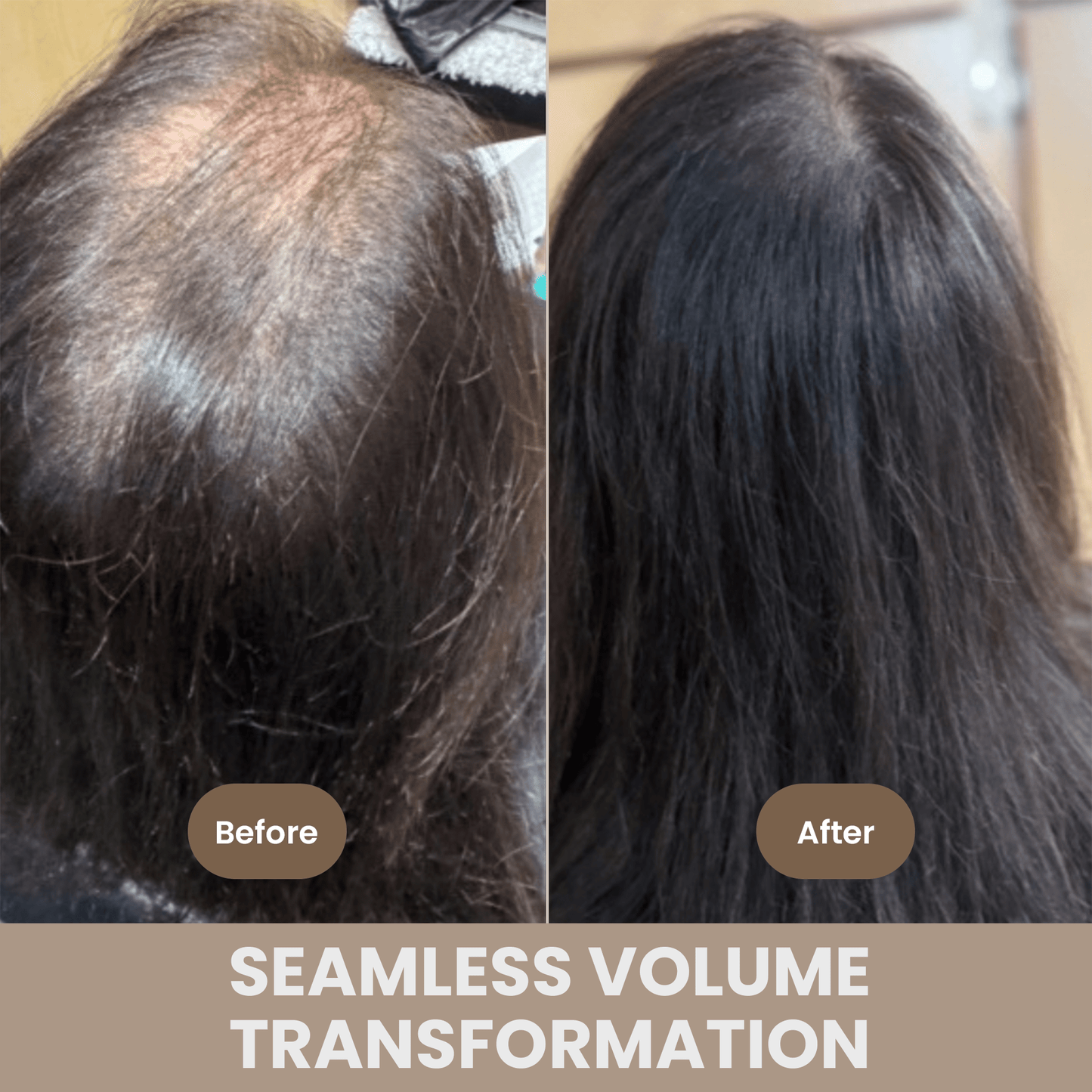 Professional V- Light Premium Extension Kit V-Light Tool V-Light Technology 